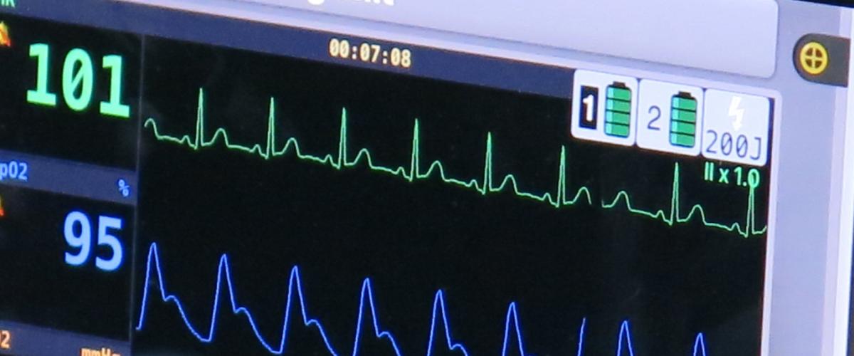 iSimulate monitor used in paramedic training