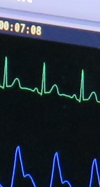 iSimulate monitor used in paramedic training