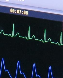 iSimulate monitor used in paramedic training